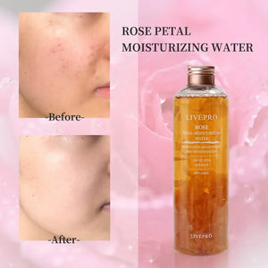 Hydrating Rose Petal Water Skin Toner - Dazzling Beauty Solution